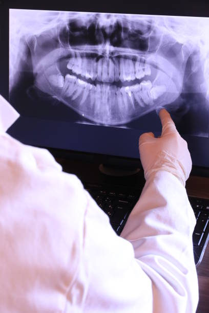 Best Emergency Dentist for Knocked-Out Tooth in Holly Springs, NC